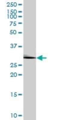 Western Blot: HABP1/C1QBP/GC1q R Antibody [H00000708-B01P] - Analysis of C1QBP expression in human liver.