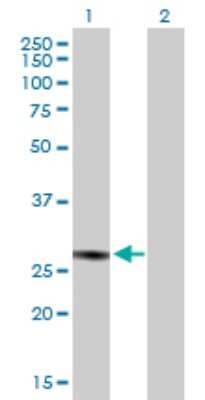 Western Blot: HABP1/C1QBP/GC1q R Antibody [H00000708-B01P] - Analysis of C1QBP expression in transfected 293T cell line by C1QBP polyclonal antibody.  Lane 1: C1QBP transfected lysate(31.02 KDa). Lane 2: Non-transfected lysate.