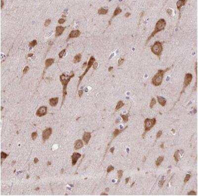 Immunohistochemistry: HABP4 Antibody [NBP2-30907] - Staining of human cerebral cortex shows strong cytoplasmic positivity in neuronal cells.