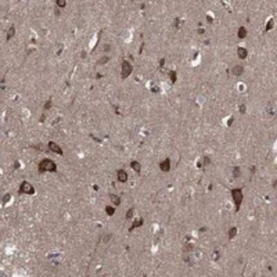 Immunohistochemistry-Paraffin: HABP4 Antibody [NBP3-17861] - Staining of human cerebral cortex shows strong cytoplasmic positivity in neuronal cells.