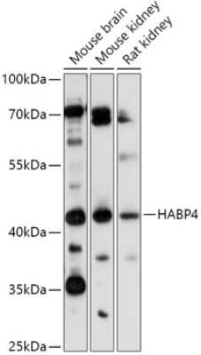 Western Blot: HABP4 Antibody [NBP3-04108] - Analysis of extracts of various cell lines, using HABP4 antibody at 1:1000 dilution. Secondary antibody: HRP Goat Anti-Rabbit IgG (H+L) at 1:10000 dilution. Lysates/proteins: 25ug per lane. Blocking buffer: 3% nonfat dry milk in TBST. Detection: ECL Basic Kit.