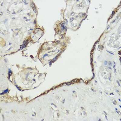 Immunohistochemistry-Paraffin HACE1 Antibody - Azide and BSA Free