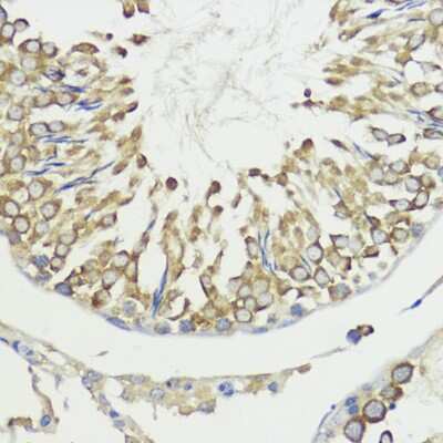 Immunohistochemistry-Paraffin HACE1 Antibody - Azide and BSA Free
