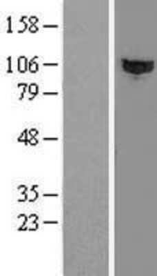 Western Blot: HACE1 Overexpression Lysate (Adult Normal) [NBL1-11433] Left-Empty vector transfected control cell lysate (HEK293 cell lysate); Right -Over-expression Lysate for HACE1.
