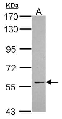 Western Blot: HACL1 Antibody [NBP2-14975] - Sample (30 ug of whole cell lysate) A: Hep G2 7. 5% SDS PAGE; antibody diluted at 1:1000.