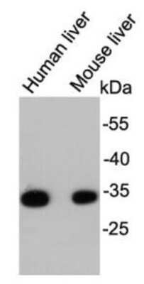 Western Blot: HADH Antibody (D10-E7) [NBP2-66880] - Analysis on different tissue lysates using anti- HADHSC mouse mAb.