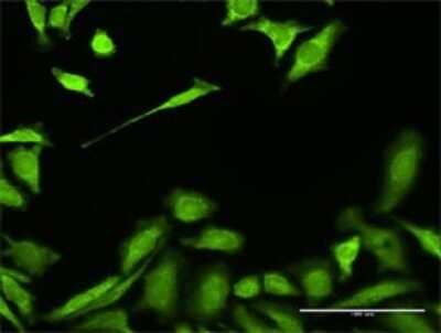 Immunocytochemistry/Immunofluorescence: HADH Antibody [H00003033-D01P] - Analysis of antibody to HADH on HeLa cell. Antibody concentration 30 ug/ml.