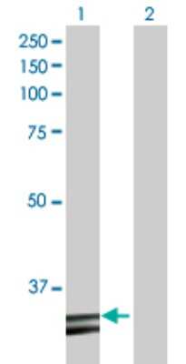 Western Blot: HADH Antibody [H00003033-D01P] - Analysis of HADH expression in transfected 293T cell line by HADH polyclonal antibody.Lane 1: HADH transfected lysate(34.30 KDa).Lane 2: Non-transfected lysate.