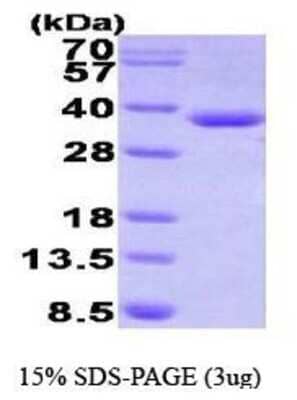 SDS-PAGE Recombinant Human HADH His Protein