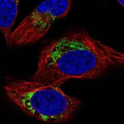 <b>Independent Antibodies Validation. </b>Immunocytochemistry/Immunofluorescence: HADHB Antibody [NBP2-56259] - Staining of human cell line U-2 OS shows localization to mitochondria.