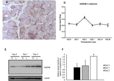 Immunohistochemistry: HADHB Antibody [NBP1-82609] - (B) IHC staining of murine adductor muscle after ischemia induction revealed expression of HADHB, predominantly in the cytoplasm of cells. (D) Microarray analysis of mRNA expression of HADHB mRNA in the adductor muscle of mice at several time points after induction of ischemia (4 mice per time point). (E) Western blot showing HADHB levels in murine adductor muscle tissue on day 0, 1, and 3 after hindlimb ligation. For each time point, samples from right (R) unligated paws and left (L) ligated paws are presented next to each other. Tubulin was used as a loading control. (F) Quantification of the western blot. The HADHB signal was normalized against tubulin. Each bar represents a biological triplicate and technical duplicate. Image collected and cropped by CiteAb from the following publication (https://linkinghub.elsevier.com/retrieve/pii/S2162253118303135) licensed under a CC-BY license.