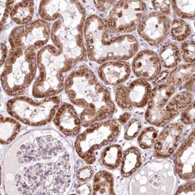Immunohistochemistry-Paraffin: HADHB Antibody [NBP2-38353] - Staining of human kidney shows strong cytoplasmic positivity in cells in tubules.
