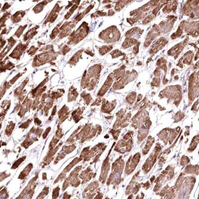 Immunohistochemistry-Paraffin: HADHB Antibody [NBP2-38353] - Staining of human heart muscle shows high expression.
