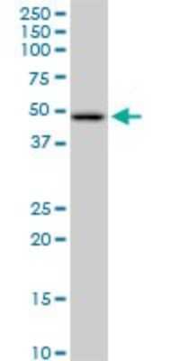 Western Blot: HADHB Antibody [H00003032-B01P] - Analysis of HADHB expression in A-431.