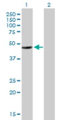 Western Blot: HADHB Antibody [H00003032-B01P] - Analysis of HADHB expression in transfected 293T cell line by HADHB polyclonal antibody.  Lane 1: HADHB transfected lysate(52.14 KDa). Lane 2: Non-transfected lysate.