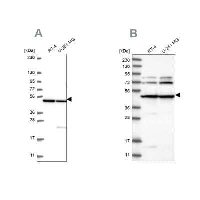 Western Blot: HADHB Antibody [NBP2-56259] - Analysis using Anti-HADHB antibody NBP2-56259 (A) shows similar pattern to independent antibody NBP1-82609 (B).