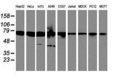 Western Blot: HAI-1/HGFA Inhibitor 1 Antibody (OTI4H2) - Azide and BSA Free [NBP2-71296] - Analysis of extracts (35ug) from 9 different cell lines by using anti-HGFA Inhibitor 1 monoclonal antibody.