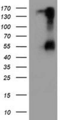 Western Blot: HAI-1/HGFA Inhibitor 1 Antibody (OTI4H2) - Azide and BSA Free [NBP2-71296] - HEK293T cells were transfected with the pCMV6-ENTRY control (Left lane) or pCMV6-ENTRY HGFA Inhibitor 1 (Right lane) cDNA for 48 hrs and lysed. Equivalent amounts of cell lysates (5 ug per lane) were separated by SDS-PAGE and immunoblotted with anti-HGFA