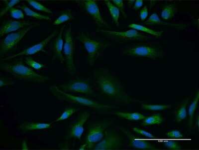 Immunocytochemistry/Immunofluorescence: HAI-2/SPINT2 Antibody [H00010653-B01P] - Analysis of purified antibody to SPINT2 on HeLa cell. (antibody concentration 10 ug/ml)