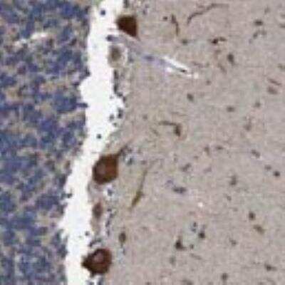 Immunohistochemistry: HAI-2/SPINT2 Antibody [26950002] -  Most of the normal tissues displayed moderate cytoplasmic positivity. Strong cytoplasmic staining was seen in exocrine pancreas and in neuronal cells while glandular cells in the intestinal tract showed strong staining of the brush border. Squamous epithelia, liver, kidney and lymphoid tissues were weakly stained or negative. Malignant tissues mainly exhibited weak to moderate cytoplasmic immunoreactivity. Lymphomas and skin cancers were negative.  Image and statement courtesy of the Human Protein Atlas (HPA).