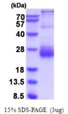 SDS-Page: HAI-2/SPINT2 Recombinant Protein [NBP2-52114] - 15% SDS Page (3 ug)