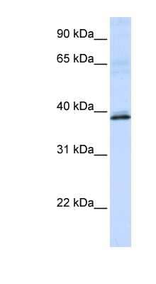 Western Blot: HAO2 Antibody [NBP1-53164] - MCF-7 whole cell lysates, concentration 0.2-1 ug/ml.