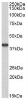 Western Blot HAO2 Antibody