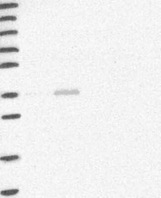 Western Blot HAO2 Antibody - BSA Free