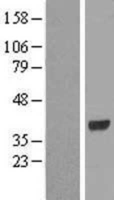 Western Blot: HAO2 Overexpression Lysate (Adult Normal) [NBP2-08851] Left-Empty vector transfected control cell lysate (HEK293 cell lysate); Right -Over-expression Lysate for HAO2.