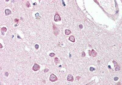 Immunohistochemistry-Paraffin: HAP1 Antibody [NB100-55413] - Staining of paraffin embedded Human Cortex. Steamed antigen retrieval with citrate buffer pH 6, AP-staining.