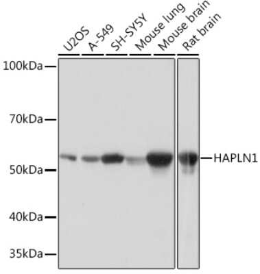 Western Blot: HAPLN1 Antibody (5O9U2) [NBP3-16486] - Western blot analysis of extracts of various cell lines, using HAPLN1 Rabbit mAb (NBP3-16486) at 1:1000 dilution. Secondary antibody: HRP Goat Anti-Rabbit IgG (H+L) at 1:10000 dilution. Lysates/proteins: 25ug per lane. Blocking buffer: 3% nonfat dry milk in TBST. Detection: ECL Basic Kit. Exposure time: 1s.