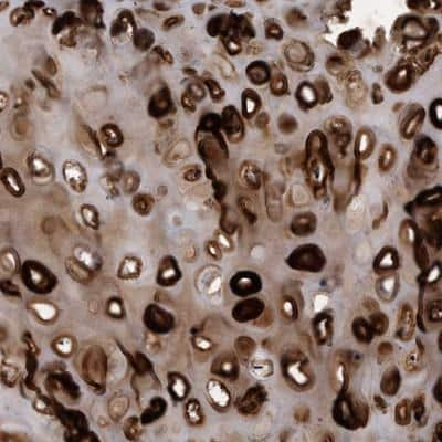 Immunohistochemistry-Paraffin: HAPLN1 Antibody [NBP1-84376] - Staining of human bronchus shows strong positivity in cartilage.