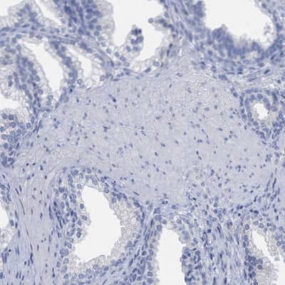 Immunohistochemistry-Paraffin: HAPLN1 Antibody [NBP1-84376] - Staining of human prostate shows low expression as expected.