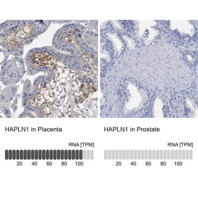 <b>Orthogonal Strategies Validation. </b>Immunohistochemistry-Paraffin: HAPLN1 Antibody [NBP1-84376] - Staining in human placenta and prostate tissues using anti-HAPLN1 antibody. Corresponding HAPLN1 RNA-seq data are presented for the same tissues.