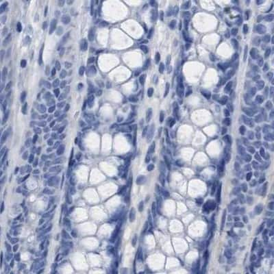 Immunohistochemistry-Paraffin: HAPLN1 Antibody [NBP1-84376] - Staining of human colon.