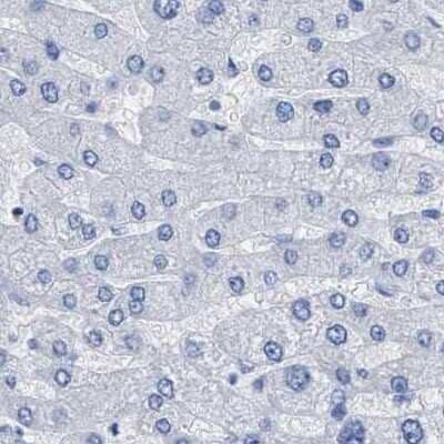 Immunohistochemistry-Paraffin: HAPLN1 Antibody [NBP1-84376] - Staining of human liver.