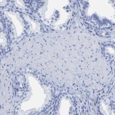 Immunohistochemistry-Paraffin: HAPLN1 Antibody [NBP1-85443] - Staining of human prostate shows low expression as expected.