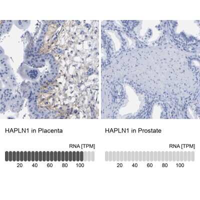 <b>Orthogonal Strategies Validation. </b>Immunohistochemistry-Paraffin: HAPLN1 Antibody [NBP1-85443] - Staining in human placenta and prostate tissues using anti-HAPLN1 antibody. Corresponding HAPLN1 RNA-seq data are presented for the same tissues.