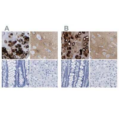 <b>Independent Antibodies Validation. </b>Immunohistochemistry-Paraffin: HAPLN1 Antibody [NBP1-85443] - Staining of human bronchus, cerebral cortex, colon and liver using Anti-HAPLN1 antibody NBP1-85443 (A) shows similar protein distribution across tissues to independent antibody NBP1-84376 (B).