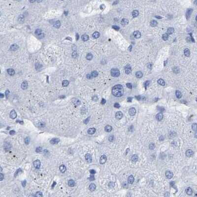 Immunohistochemistry-Paraffin: HAPLN1 Antibody [NBP1-85443] - Staining of human liver.