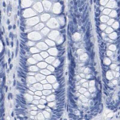 Immunohistochemistry-Paraffin: HAPLN1 Antibody [NBP1-85443] - Staining of human colon.