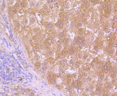 Immunohistochemistry-Paraffin: HAPLN1 Antibody (SY02-17) [NBP2-67447] - Analysis of paraffin-embedded human liver tissue using anti-HAPLN1 antibody. Counter stained with hematoxylin.