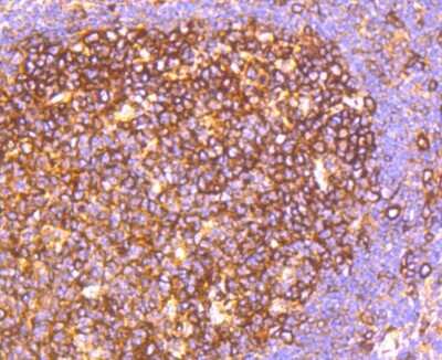 Immunohistochemistry-Paraffin: HAPLN1 Antibody (SY02-17) [NBP2-67447] - Analysis of paraffin-embedded human tonsil tissue using anti-HAPLN1 antibody. Counter stained with hematoxylin.