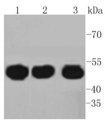 Western Blot: HAPLN1 Antibody (SY02-17) [NBP2-67447] - Analysis of HAPLN1 on different lysates using anti-HAPLN1 antibody at 1/1,000 dilution. Positive control: Lane 1: BT-20 Lane 2: HUVEC Lane 3: SW480