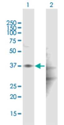Western Blot: HAPLN1 Antibody [H00001404-B01P] - Analysis of HAPLN1 expression in transfected 293T cell line by HAPLN1 polyclonal antibody.  Lane 1: HAPLN1 transfected lysate(39.05 KDa). Lane 2: Non-transfected lysate.