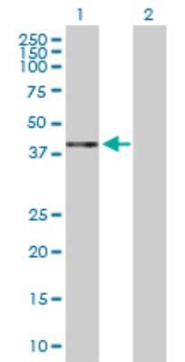 Western Blot: HAPLN1 Antibody [H00001404-D01P] - Analysis of HAPLN1 expression in transfected 293T cell line by HAPLN1 polyclonal antibody.Lane 1: HAPLN1 transfected lysate(40.20 KDa).Lane 2: Non-transfected lysate.