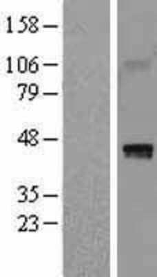 Western Blot: HAPLN1 Overexpression Lysate (Adult Normal) [NBL1-11444] Left-Empty vector transfected control cell lysate (HEK293 cell lysate); Right -Over-expression Lysate for HAPLN1.