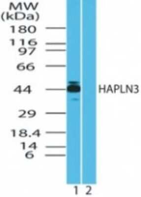 Western Blot: HAPLN3 Antibody [NBP2-24476] - Analysis of human HAPLN3 in HeLa cell lysate in the 1) absence and 2) presence of immunizing peptide using NBP2-24476 at 2 ug/ml.