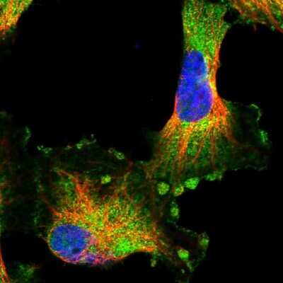 Immunocytochemistry/Immunofluorescence: HARBI1 Antibody [NBP1-88384] - Staining of human cell line U-251 MG shows localization to plasma membrane & cytosol.