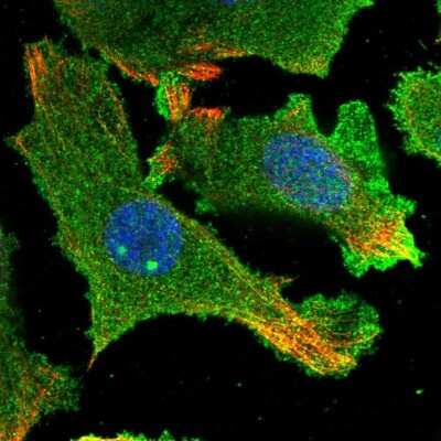 Immunocytochemistry/Immunofluorescence: HARBI1 Antibody [NBP2-55680] - Staining of human cell line PC-3 shows localization to plasma membrane & cytosol.